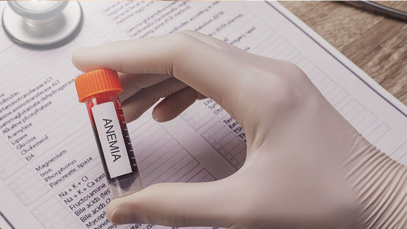 Mengenal Berbagai Jenis Anemia Selain Kekurangan Zat Besi – PAFI Curup